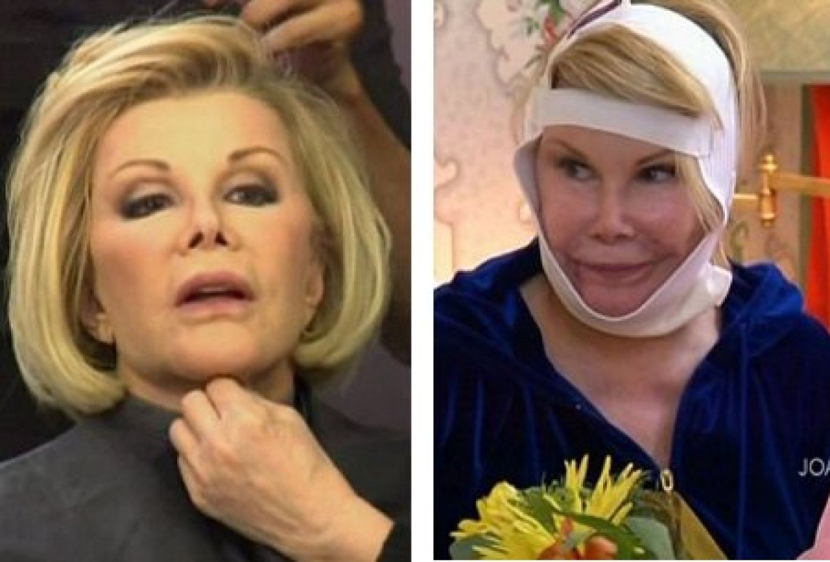 Joan Rivers